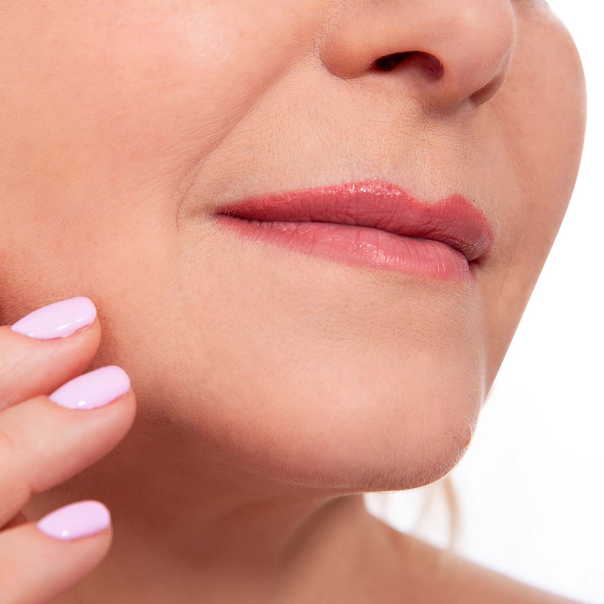 traitement des rides - après