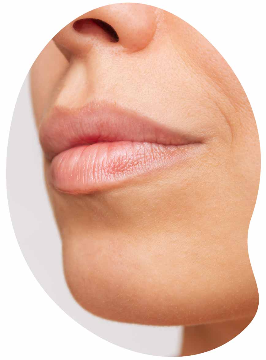 injections des lèvres après