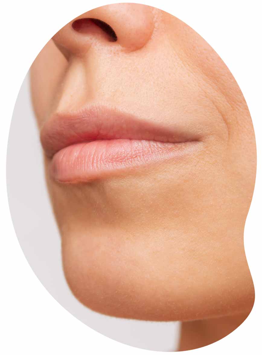 injections des lèvres avant