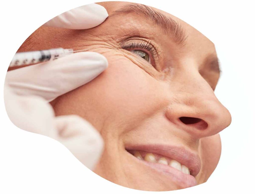 injection d’acide hyaluronique pour combler les rides